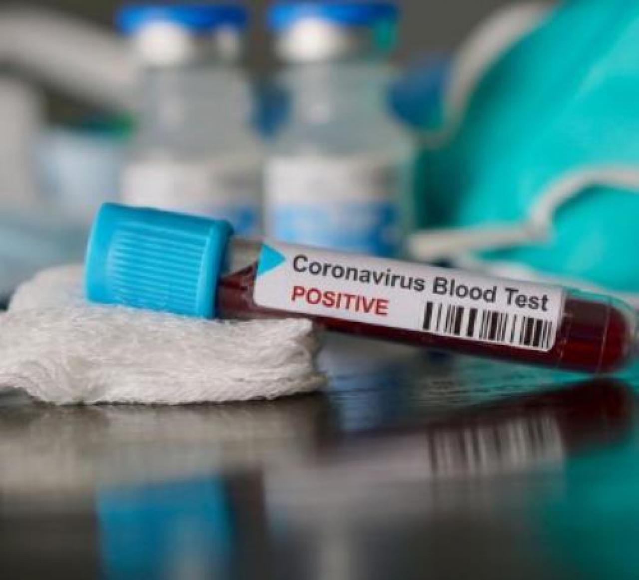 Paesana, salgono a 4 i casi segnalati