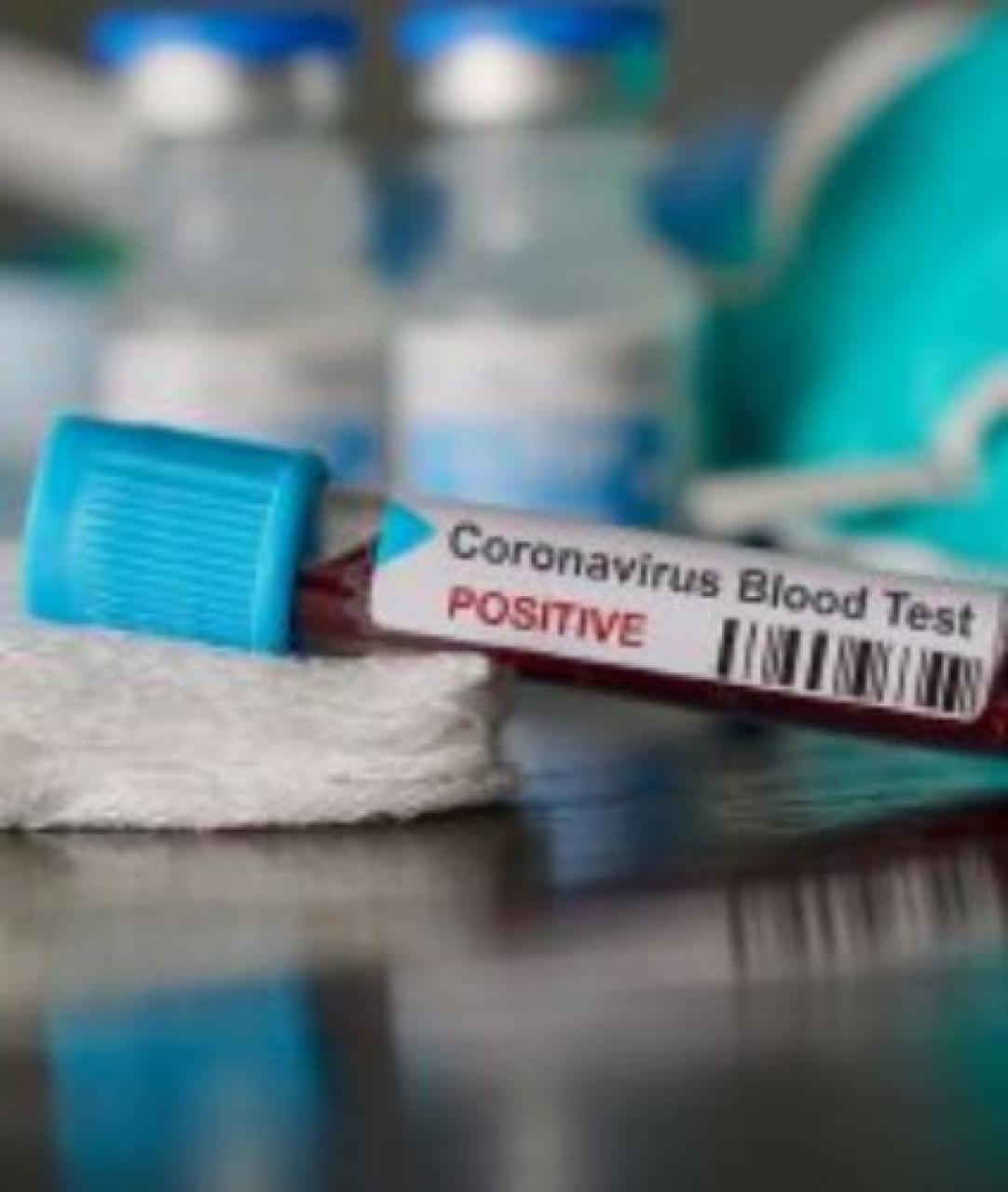 Covid, nuovo caso a Dronero